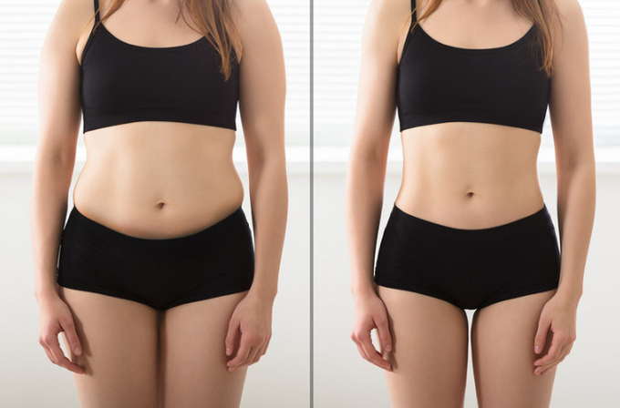 VB12 Bromelain Lecithin Lipolysis Solution Suitable For All Skin Types OEM/ODM customized brand